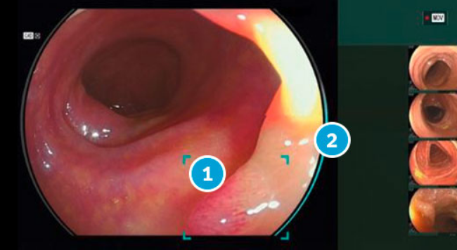 screenshot 2026 07 20 at 22 45 28 endoscopia fujifilm