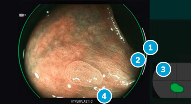 screenshot 2026 07 20 at 22 45 42 endoscopia fujifilm